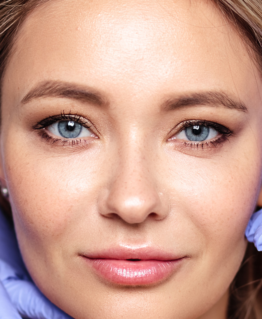 blefaroplastica-milano