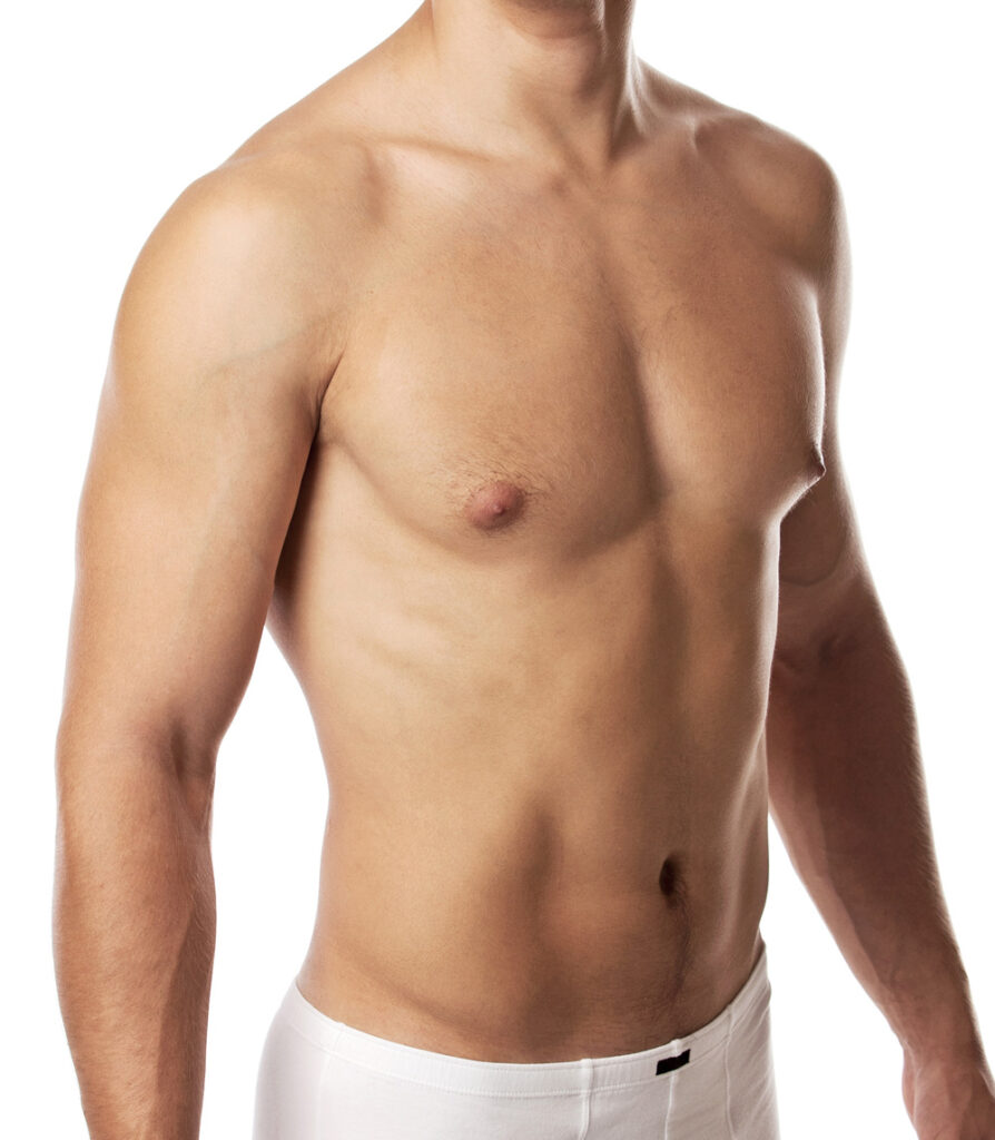 ginecomastia-candidato
