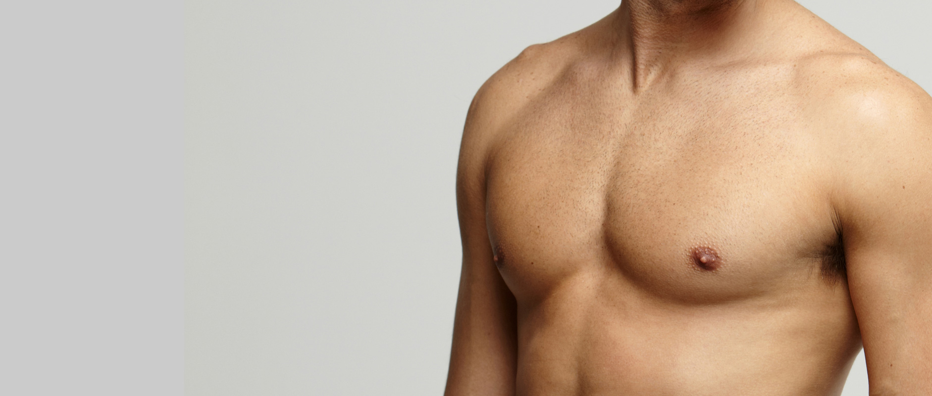 ginecomastia